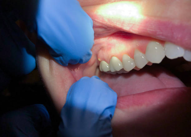 Best Cosmetic Emergency Dentistry in Tomball, TX