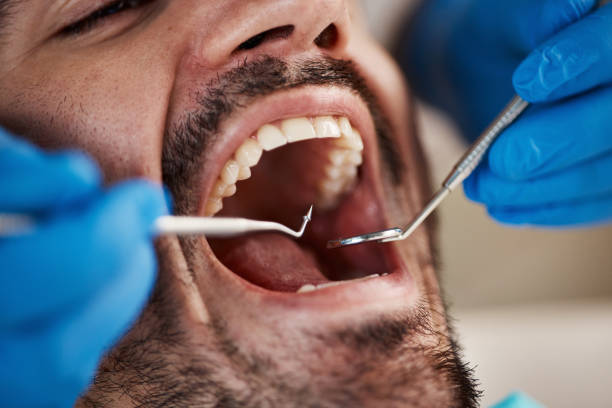 Best Emergency Tooth Extraction in Tomball, TX