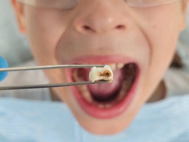 Best Emergency TMJ Treatment in Tomball, TX